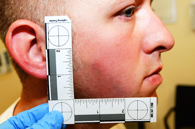 Ferguson PO Darren Wilson injuries 3