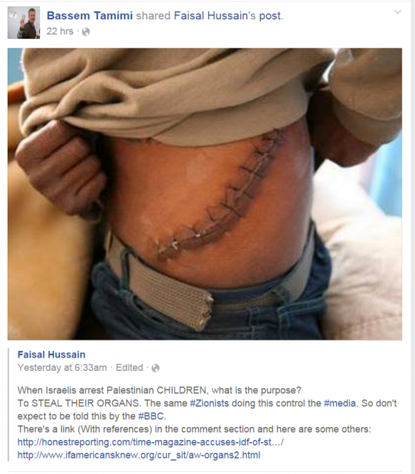 Bassem Tamimi FB Israel Organ Stealing Children